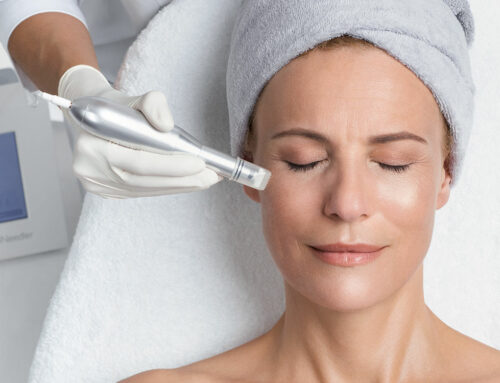 MICRO NEEDLING